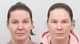 Slider image (6) AB Plastic Surgery